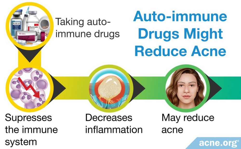 Auto-immune Drugs Might Reduce Acne