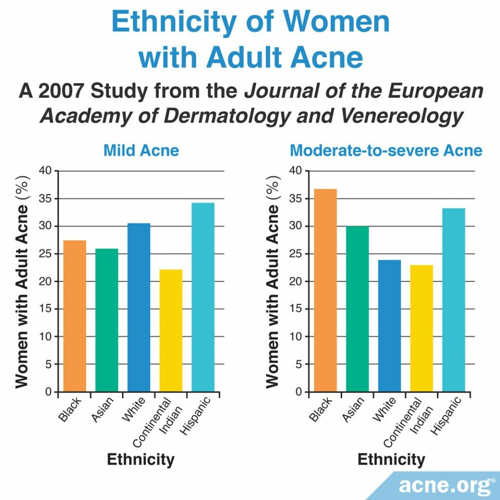Ethnicity of Women with Adult Acne