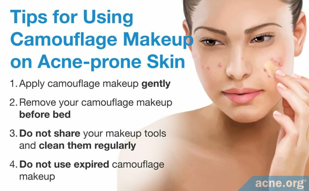 Tips for Using Camouflage Makeup on Acne-prone Skin