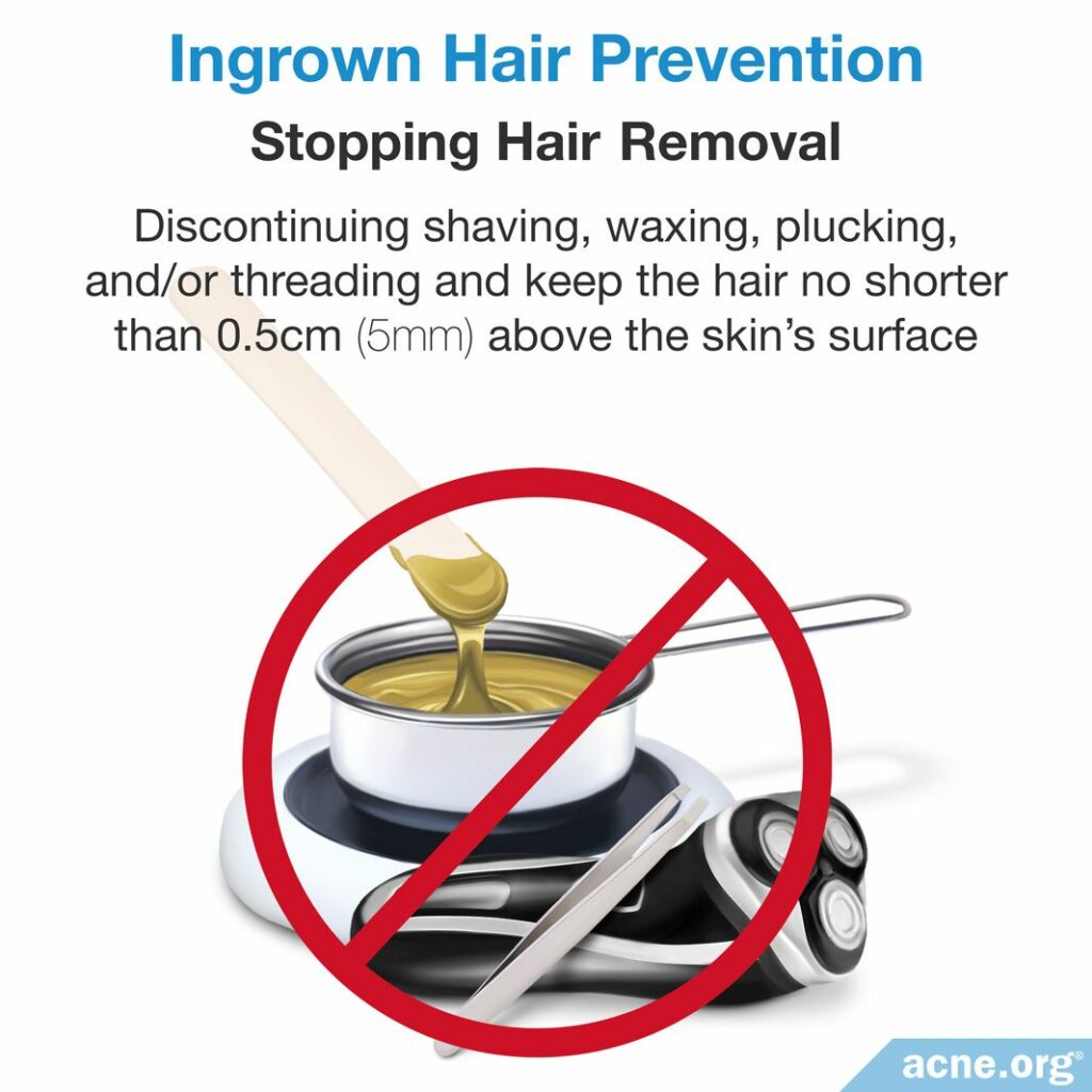 Ingrown Hair Prevention Stopping Hair Removal