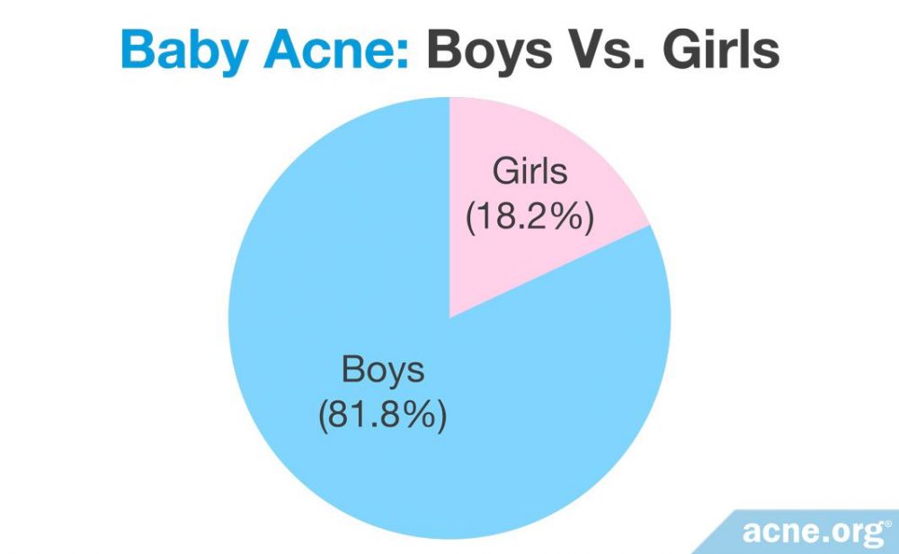 Baby Acne - Boys Vs. Girls
