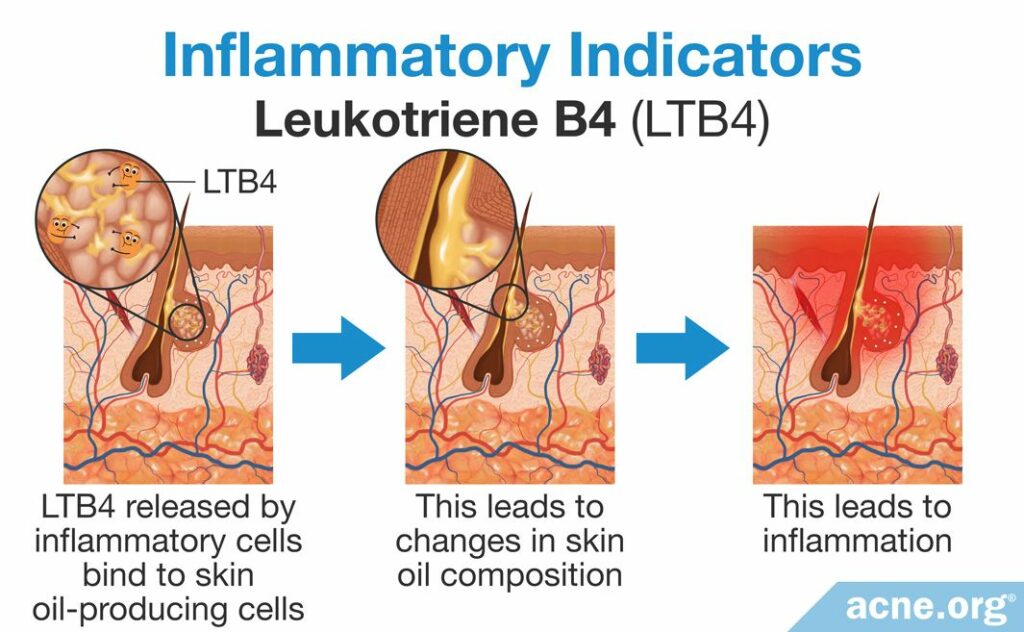 Inflammatory Indicators Leukotriene B4 (LTB4)