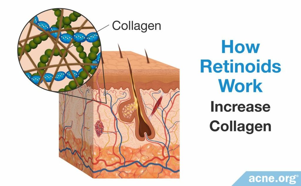 How Retinoids Work Increase Collagen