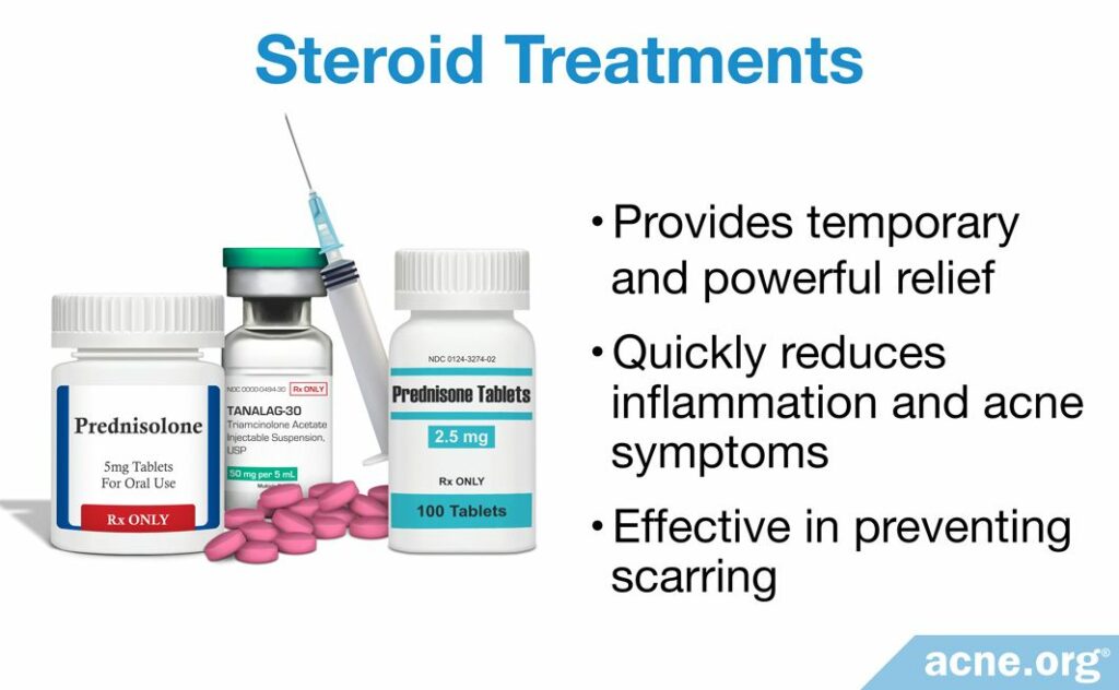 Steroid Treatments for Cystic Acne