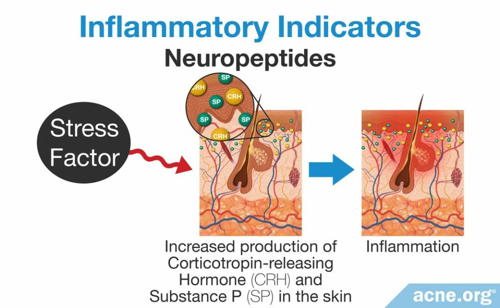 Inflammatory Indicators Neuropeptides