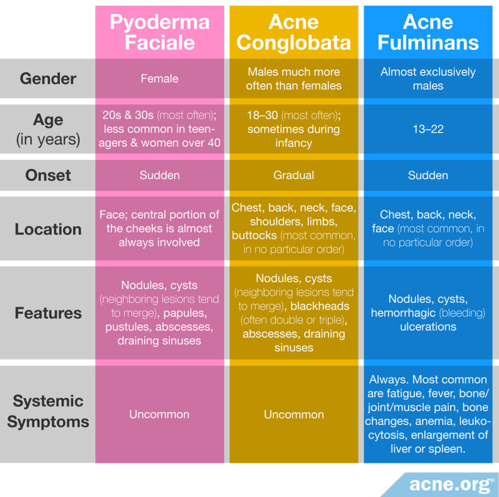 Characteristics of Nodulocystic Acne Types