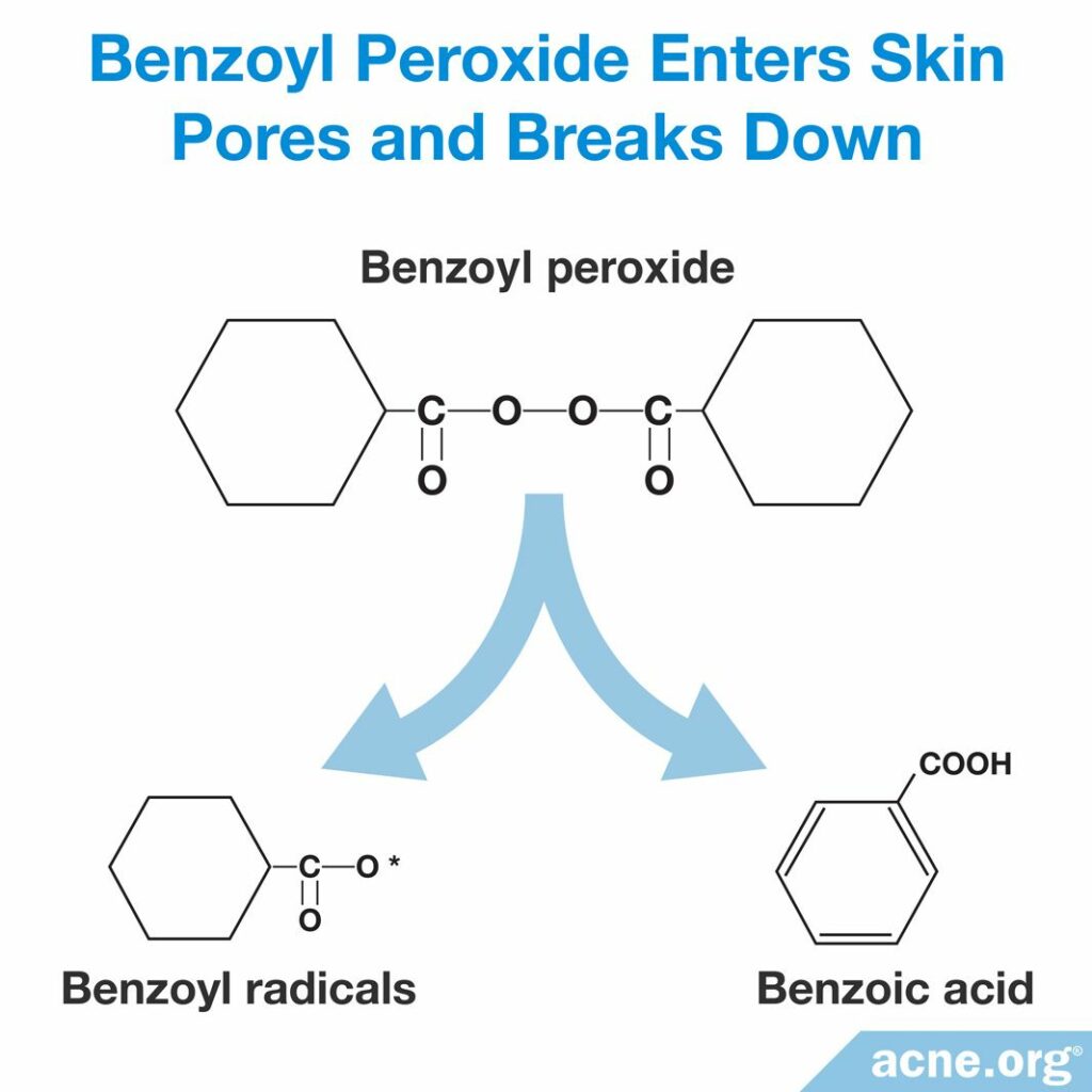 Benzoyl Peroxide Enters Skin Pores and Breaks Down