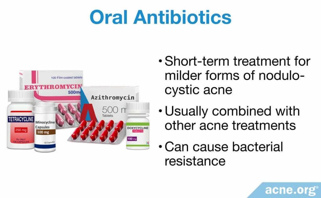 Oral Antibiotics for Cystic Acne
