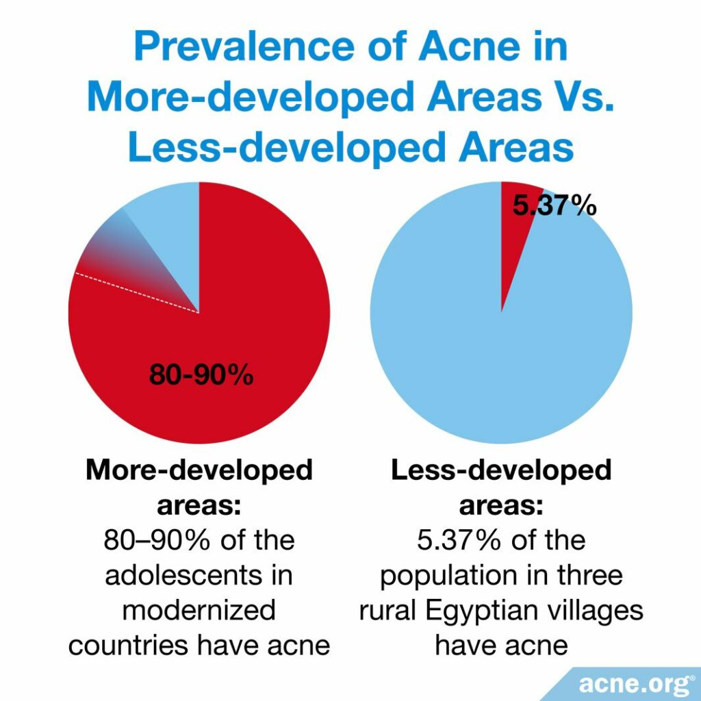 Prevalence of Acne in More-developed Areas vs. Less-developed Areas