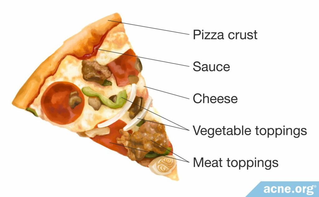 Pizza Components and Acne