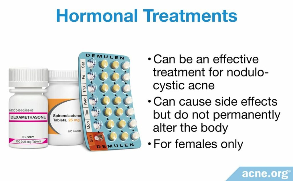 Hormonal Treatments for Cystic Acne