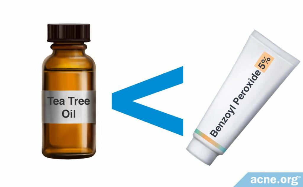 Tea Tree Oil Vs. Benzoyl Peroxide
