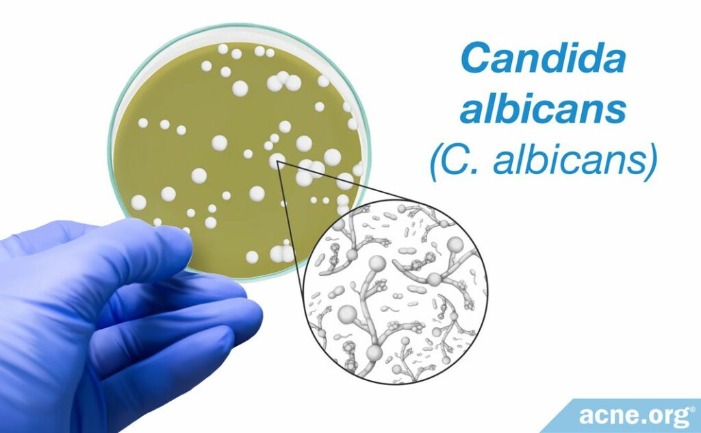 Candida albicans