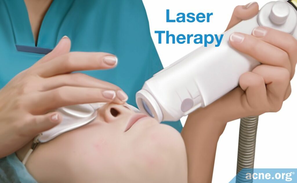Laser Therapy for Enlarged Pores