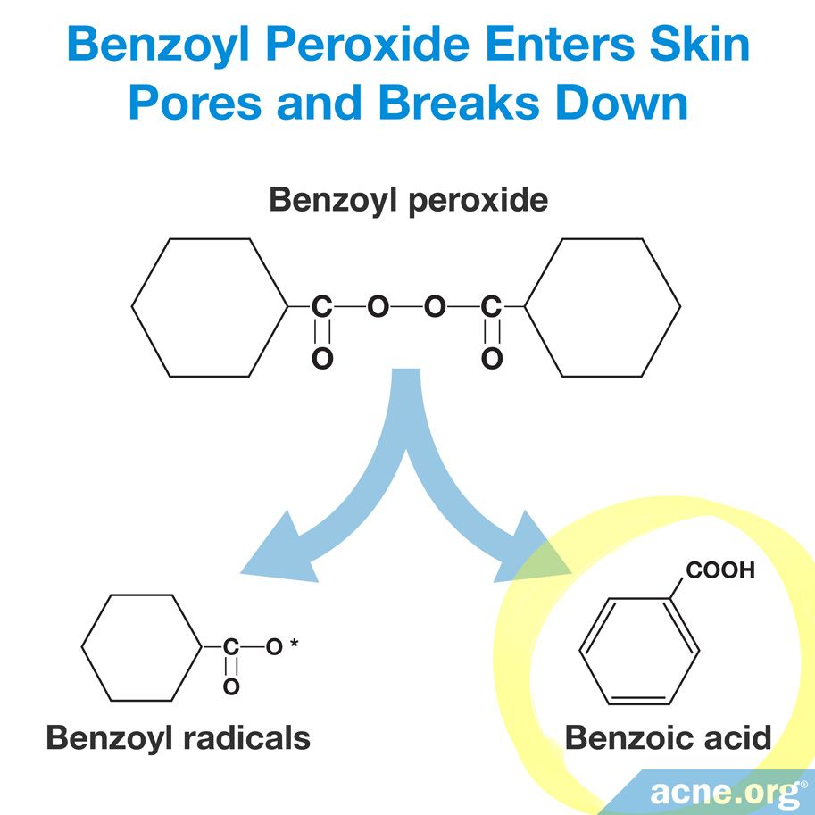 Benzoyl Peroxide Enters Skin Pores and Breaks Down Into Benzoyl Radicals and Benzoic Acid