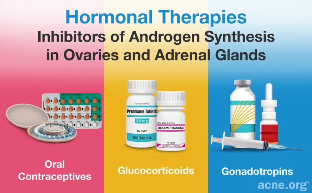 Hormonal Therapies for Oily Skin Inhibitors of Androgen Synthesis in Ovaries and Adrenal Glands Oral Contraceptives Glucocorticoids Gonadotropins