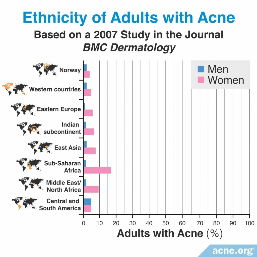 Ethnicity of Adults with Acne