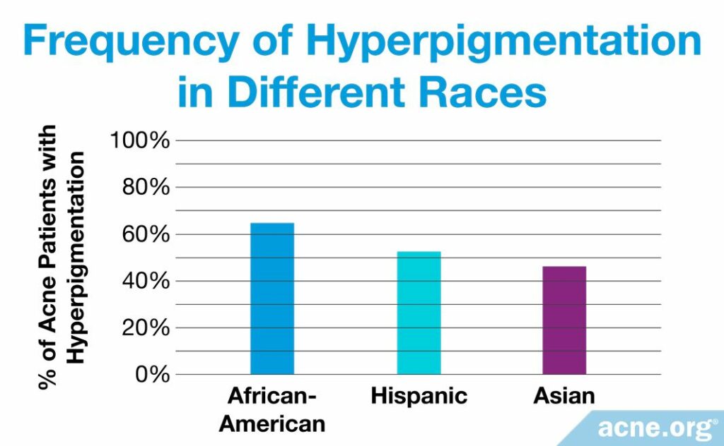 Frequency of Hyperpigmentation in Different Races