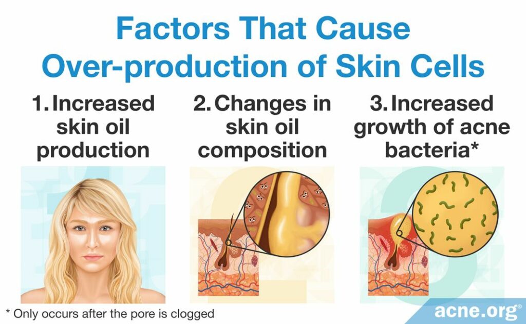 Factors That Cause Over-production of Skin Cells