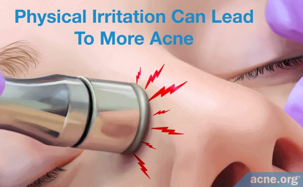 Physical Irritation Can Lead to More Acne