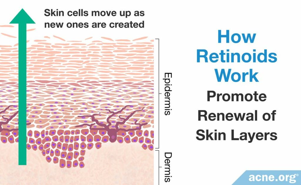 How Retinoids Work Promote Renewal of Skin Layers