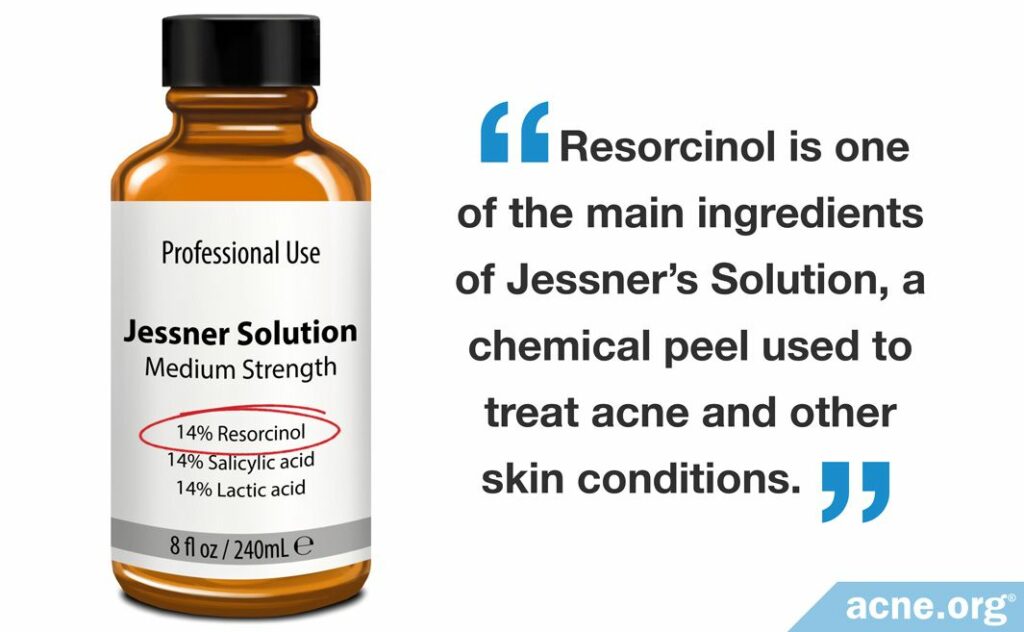 Resorcinol is one of the main ingredients of Jessner's Solution, a chemical peel used to treat acne and other skin conditions.