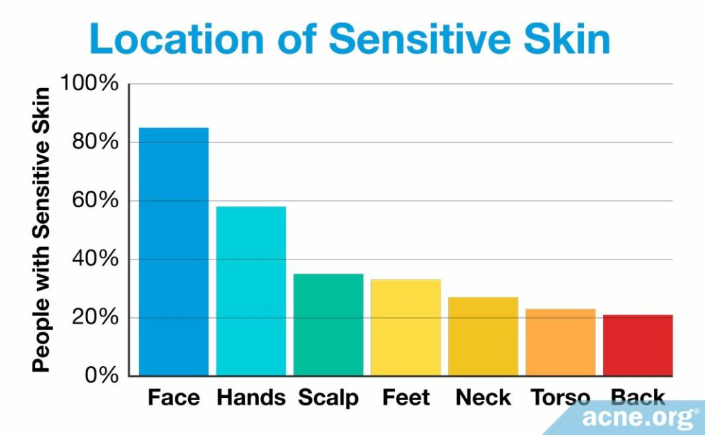 Location of Sensitive Skin