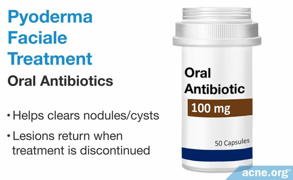 Pyoderma Faciale Treatment Oral Antibiotics