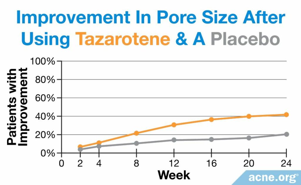 Improvement in Pore Size After Using Tazarotene & A Placebo