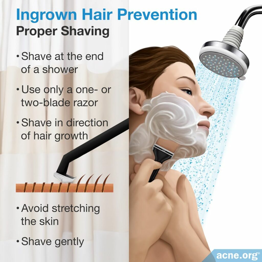 Ingrown Hair Prevention Proper Shaving