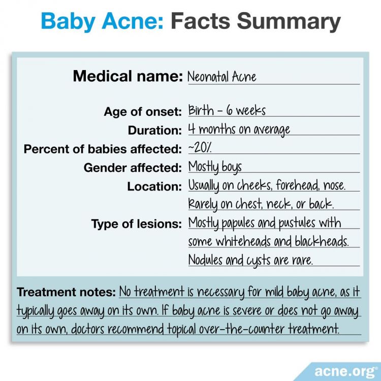 Baby Acne Facts Summary