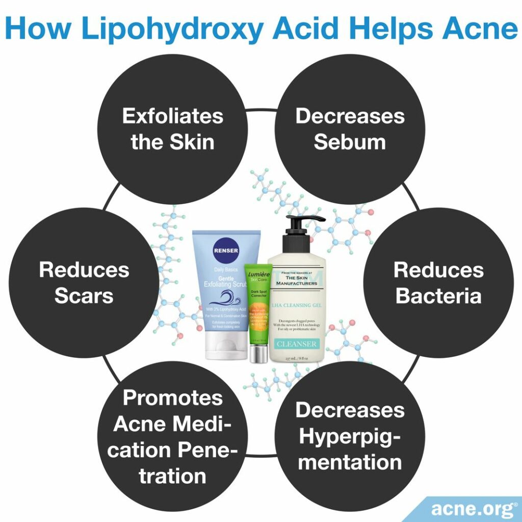 How Lipohydroxy Acid Helps Acne