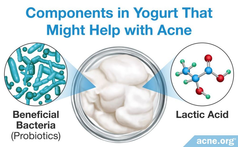Components in Yogurt That Might Help with Acne