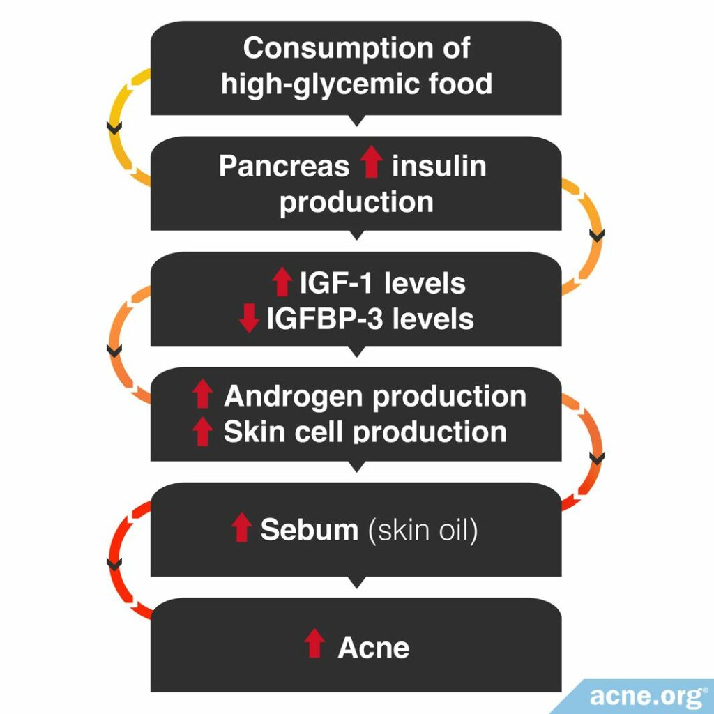 How the Consumption of High-glycemic Foods Could Lead to Increased Acne