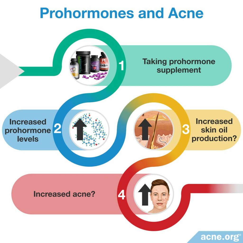 Prohormones and Acne