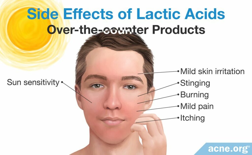 Side Effects of Over-the-counter Lactic Acid Products