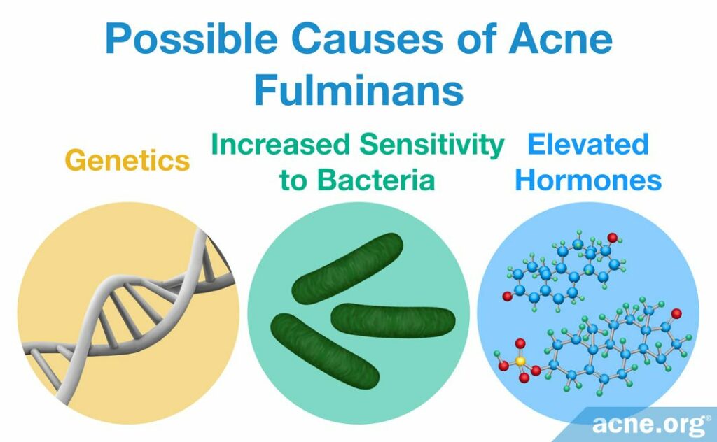 Possible Causes of Acne Fulminans