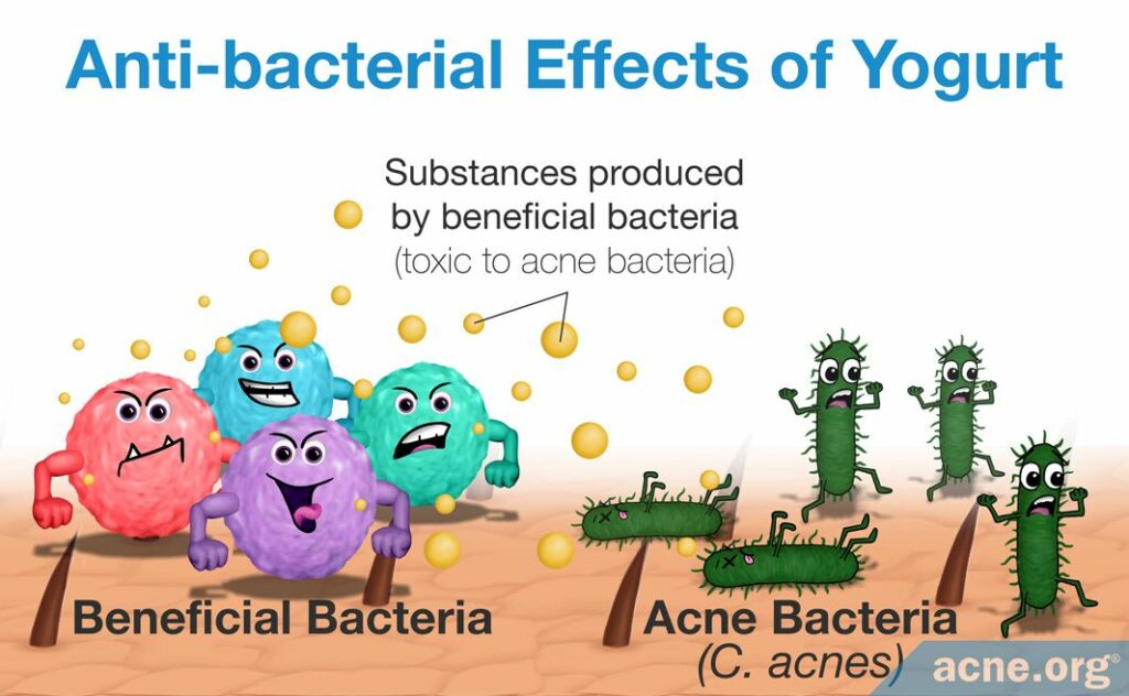 Anti-bacterial Effects of Yogurt