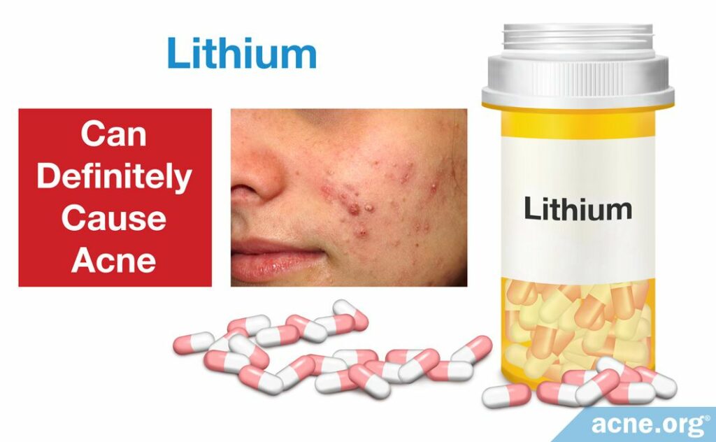 Lithium Can Definitely Cause Acne