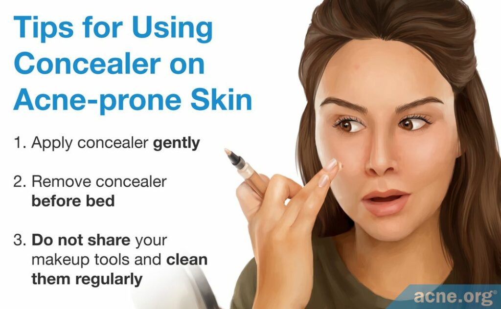 Tips for Using Concealer on Acne-prone Skin