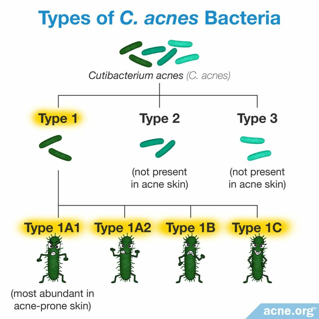 Types of C. acnes Bacteria