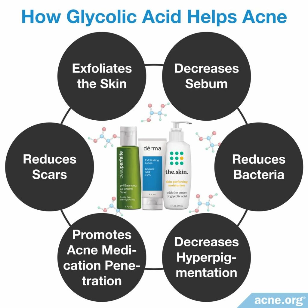 How Glycolic Acid Helps Acne