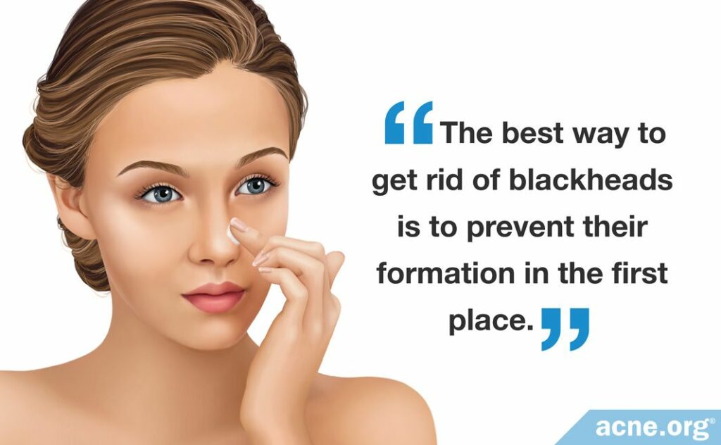 The best way to get rid of blackheads is to prevent their formation in the first place.