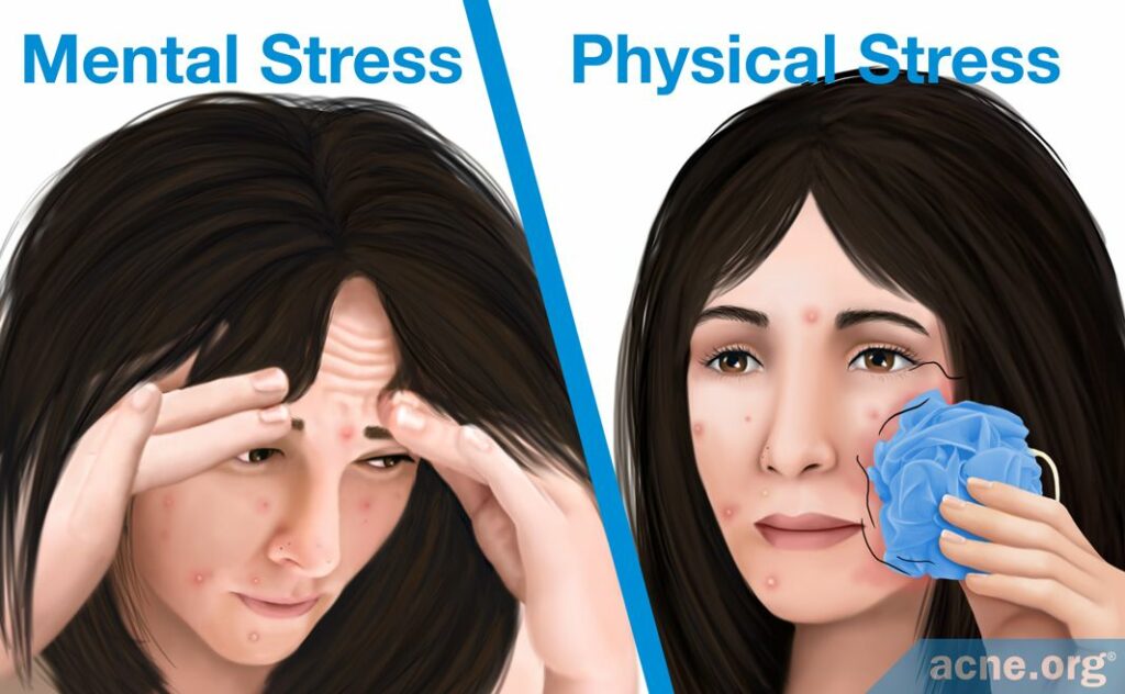 Mental Stress Versus Physical Stress