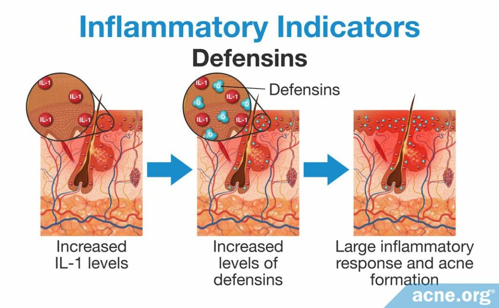 Inflammatory Indicators Defensins
