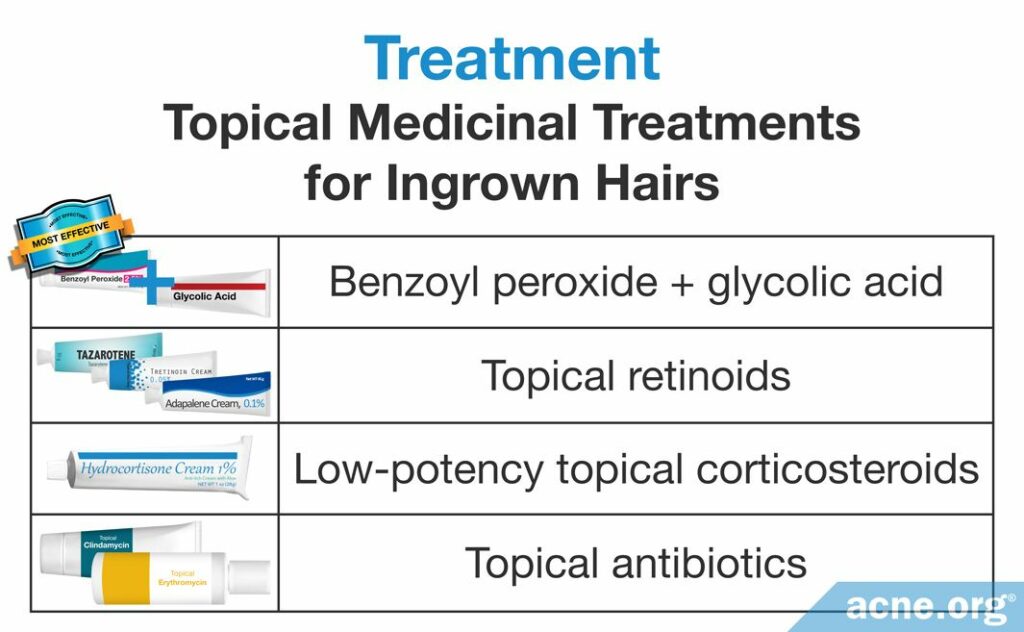 Topical Medicinal Treatments for Ingrown Hairs