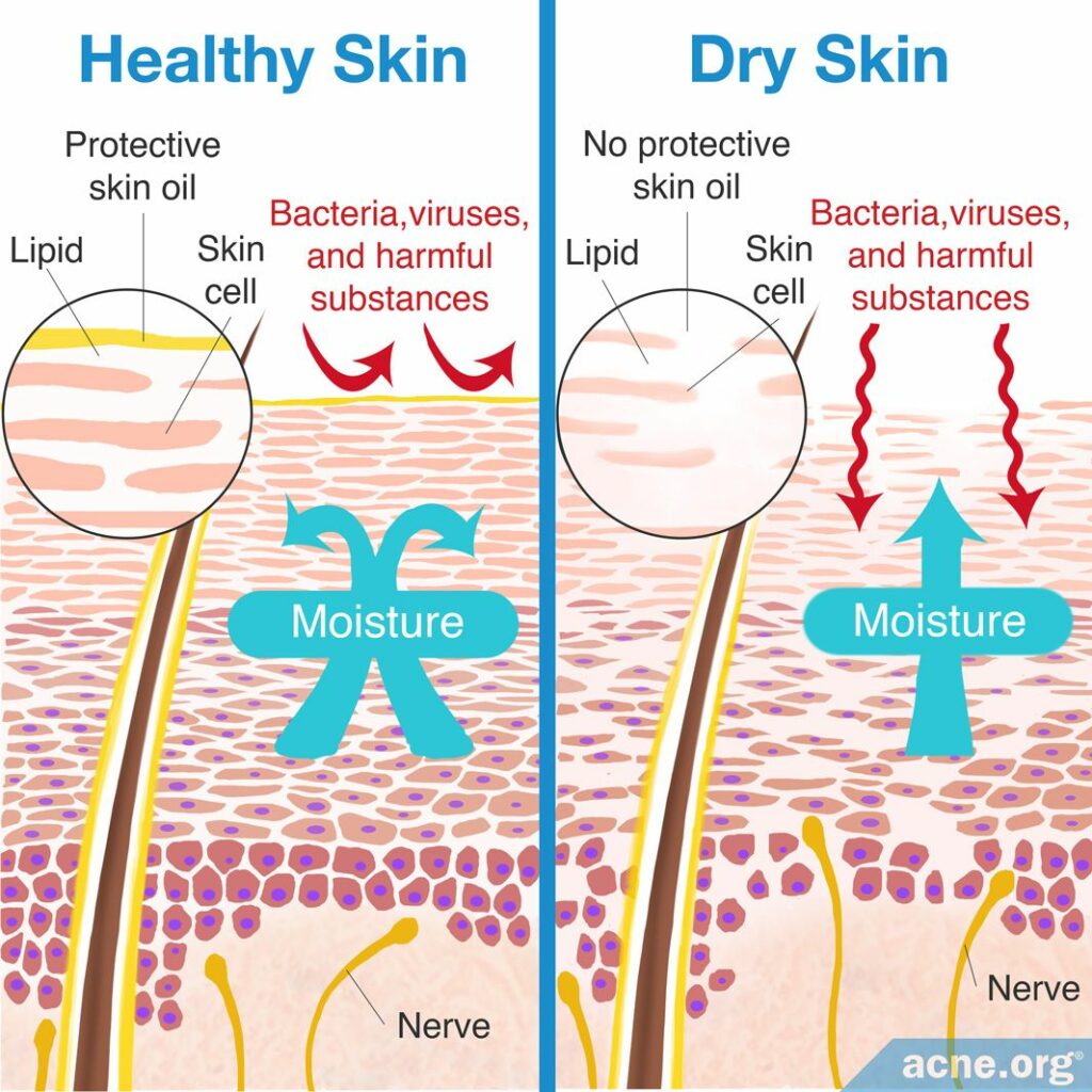 Healthy Skin Versus Dry Skin