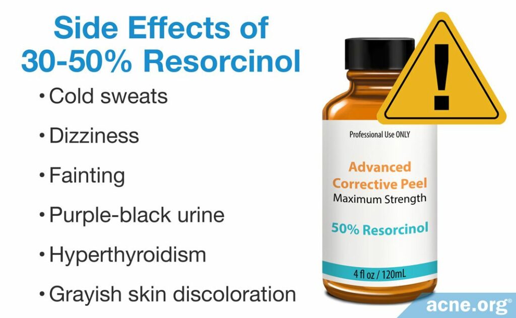 Side Effects of 30-50% Resorcinol