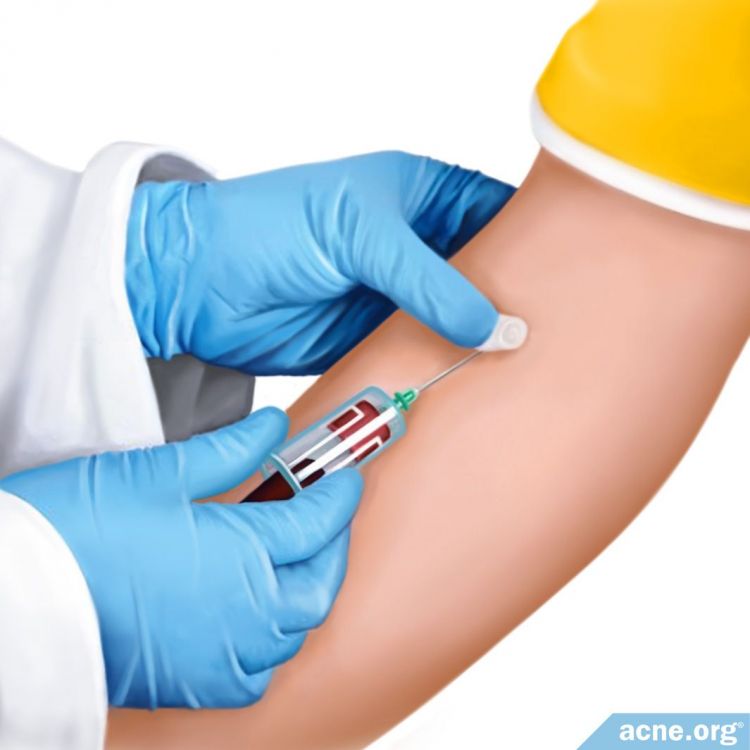 Phlebotomy Blood Draw to Test Vitamin D Levels