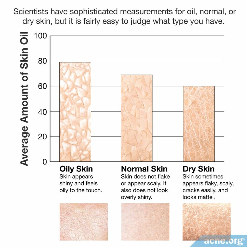 Scientists have sophisticated measurements for oil, normal, or dry skin, but it is fairly easy to judge what type you have.